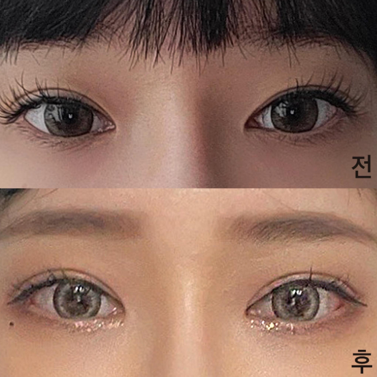 눈 재수술한 지 벌써 두 달정도 됐어요ㅎ
