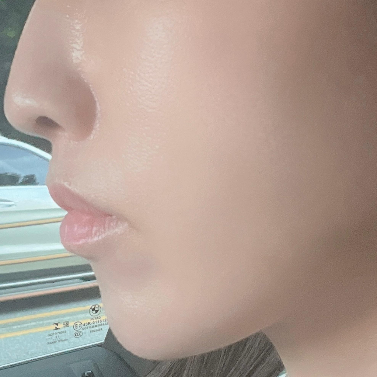 신경 쓰이던 팔자주름 개선했어요!