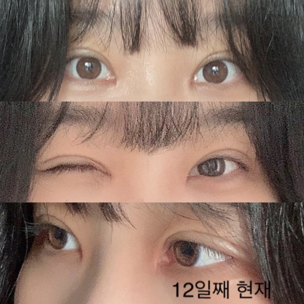 눈 찐만족 찐후기글