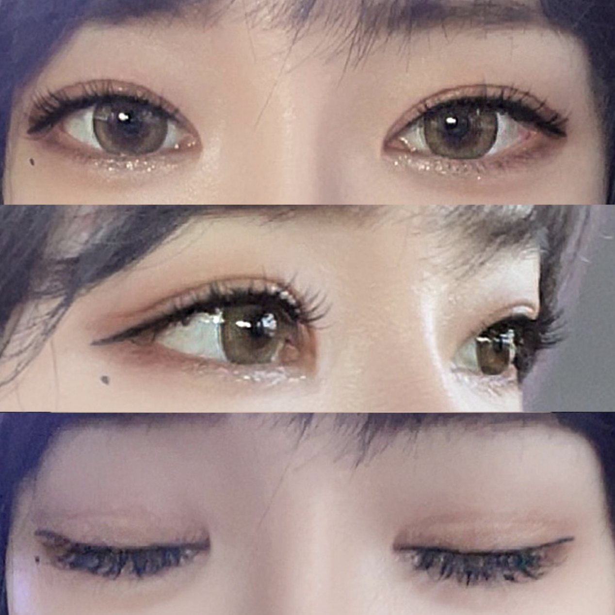 눈 재수술하고 4개월이 지났어요.