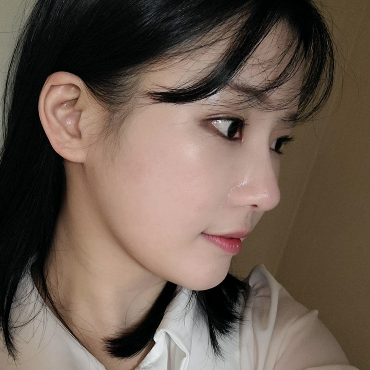 위버스성형외과에서 눈,코재수술한지 벌써 2달 됐어요