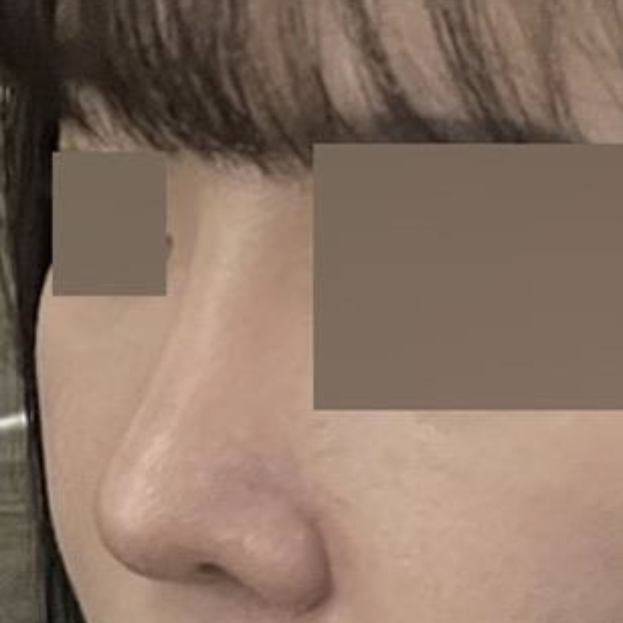 수술한지 벌써 4개월이 지났습니다!! ㅎㅎ