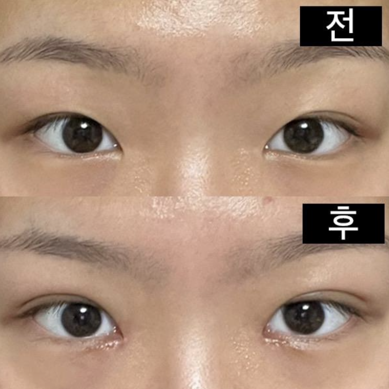 전/후 모두 기본 카메라로 찍었어요!