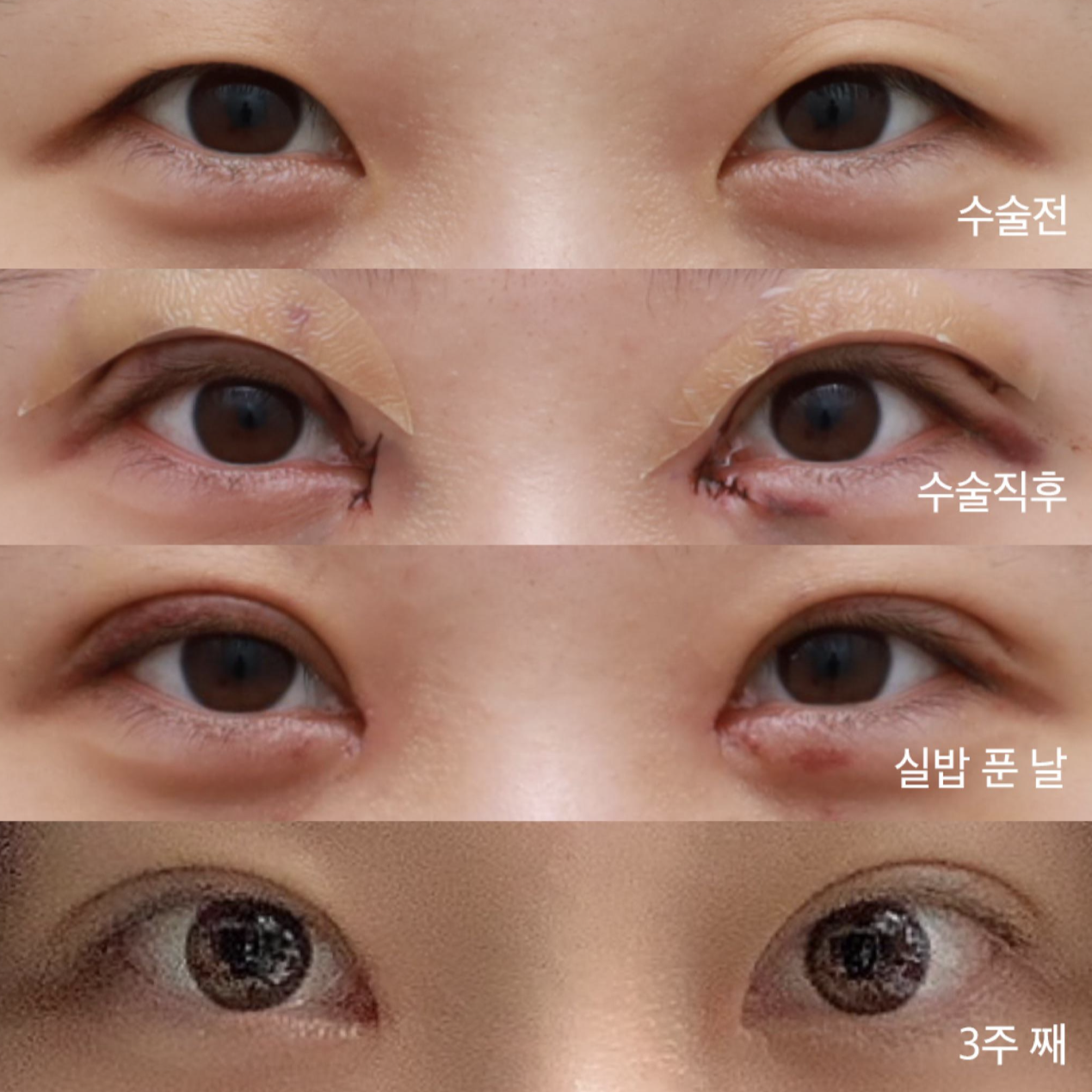 ! 2차후기 ! 찐 후기입니다.