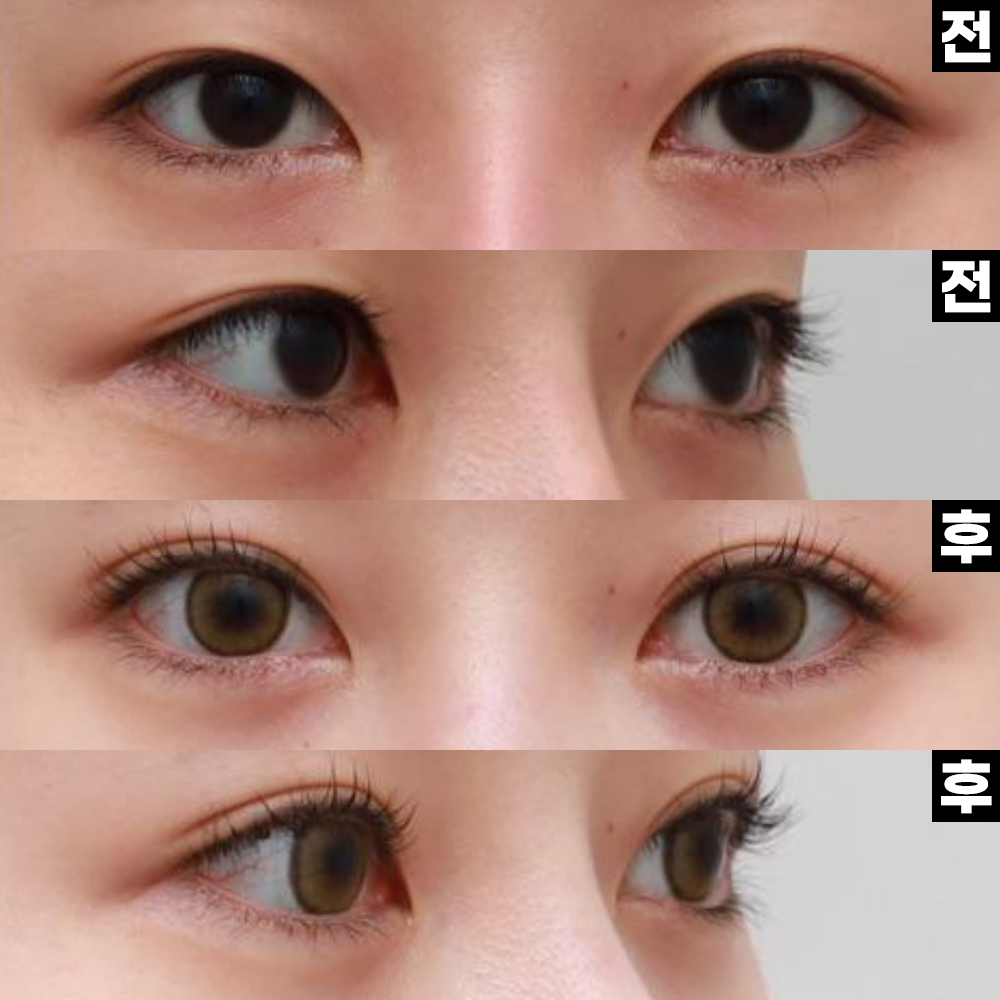 너무 자연스럽고 너무 보기좋습니다!