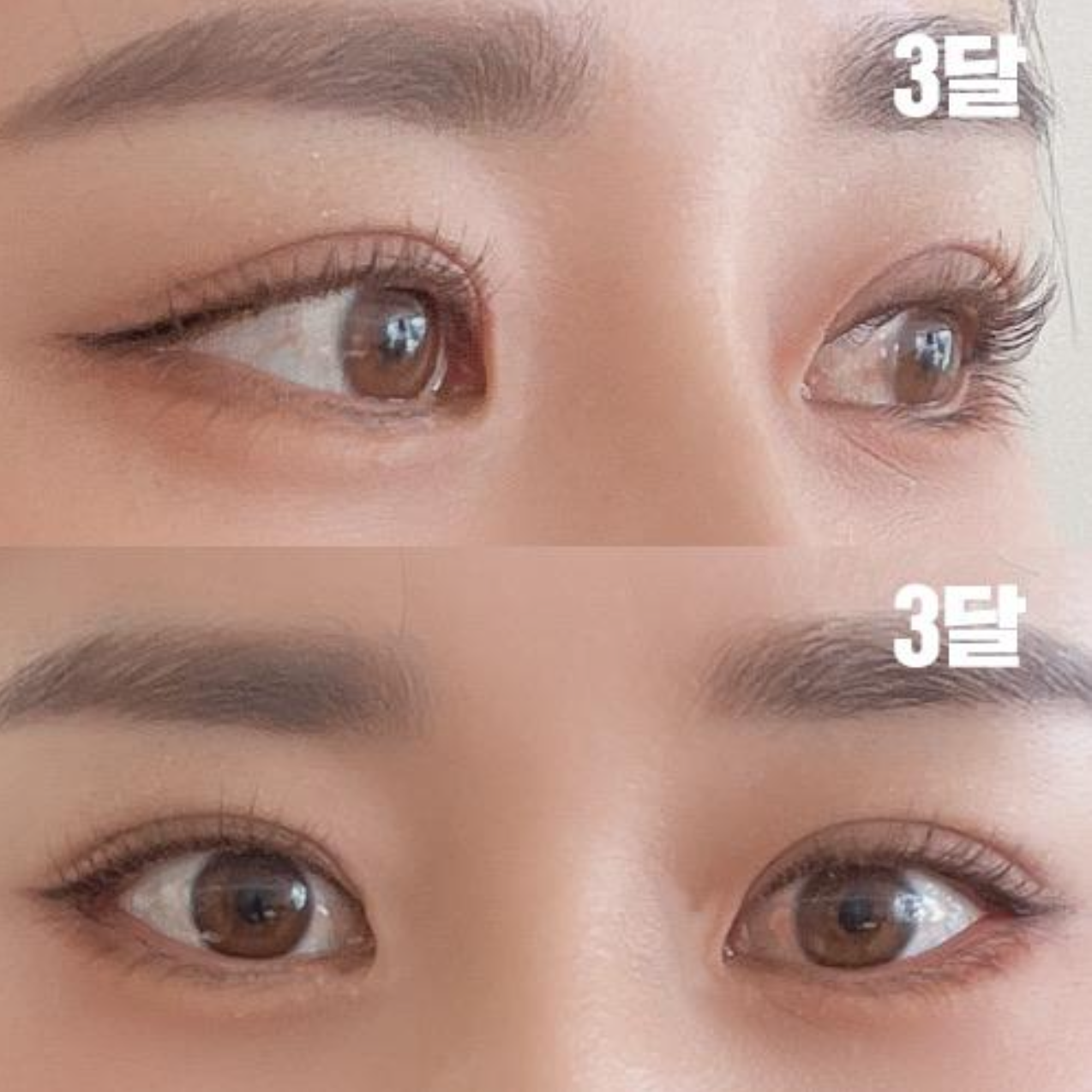 제가 원하는 스타일로 수술 잘 해주셨어요!!