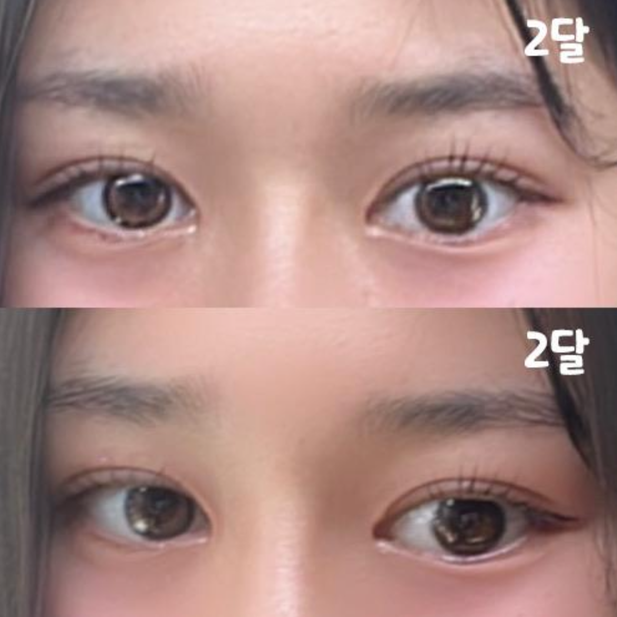 몰라볼 정도로 예쁘게 변했습니다.