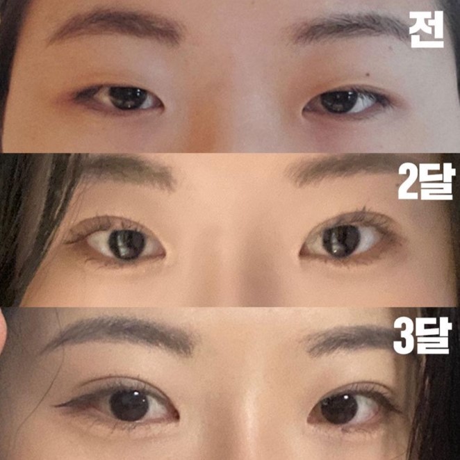 벌써 3개월이 되었는데 정말 자연스러워요