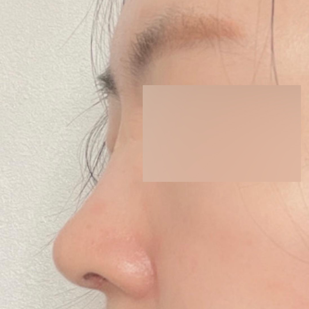 너무 이뻐져서 쌩얼도 자신이 생겼어요