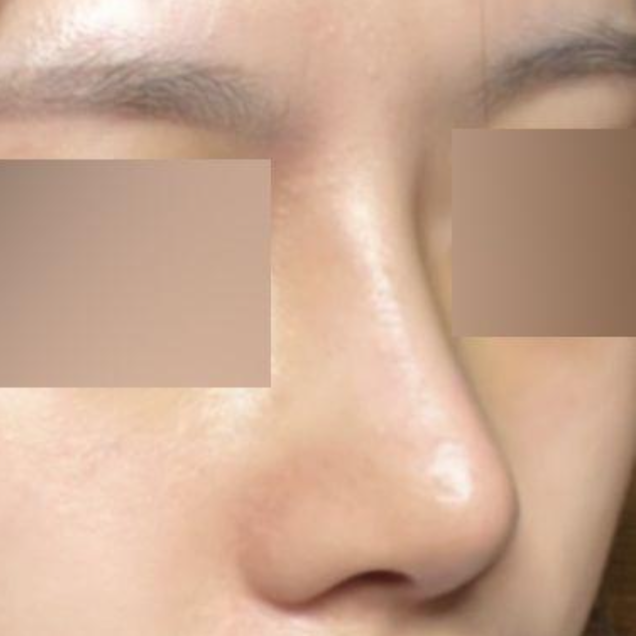 첫수술이지만 성공적인 느낌이 더 많이 드네요