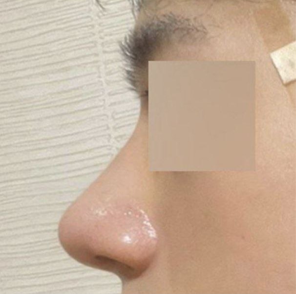 정말 세밀하게 봐주시고 설명도 잘해주시더라고요!