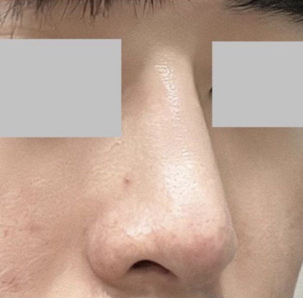 자연스러운걸 원했는데 딱 저랑 맞았던거 같아요