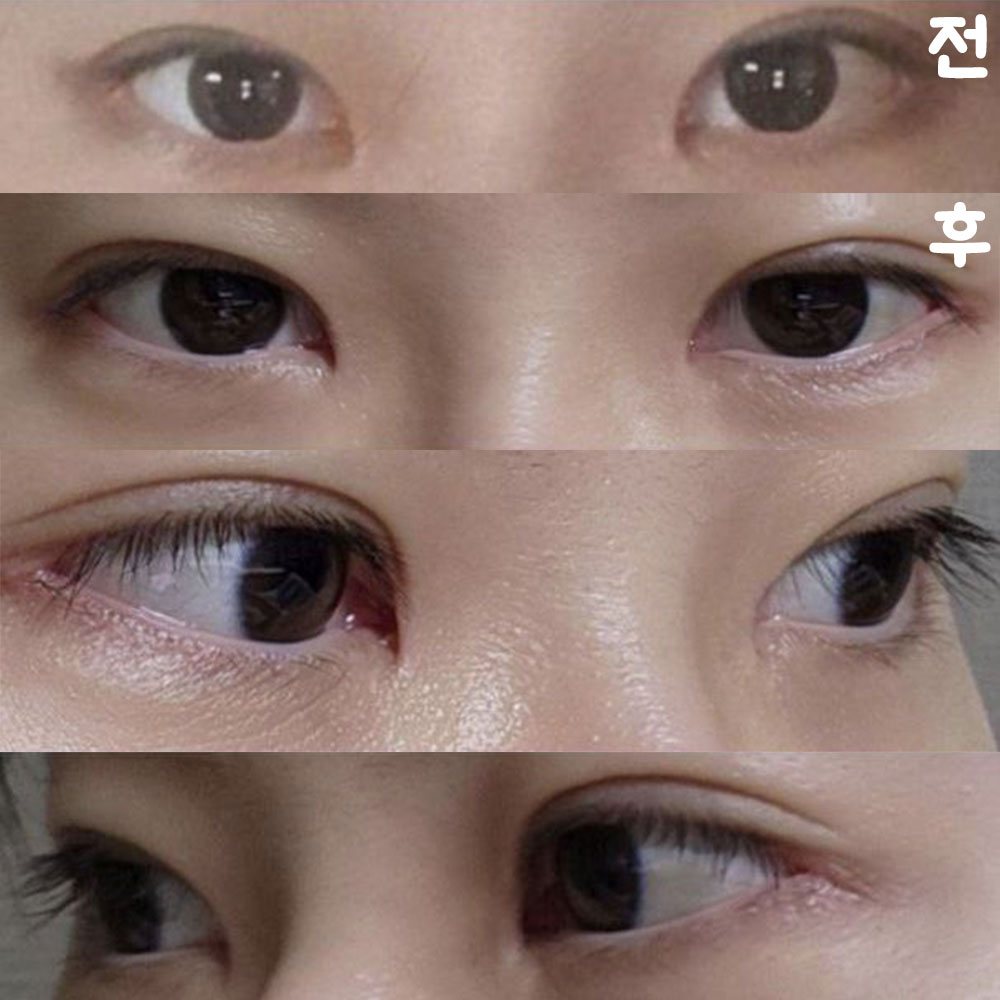 훨씬 답답한 게 없어지고 시원해보여서 너무 만족스럽습니다!