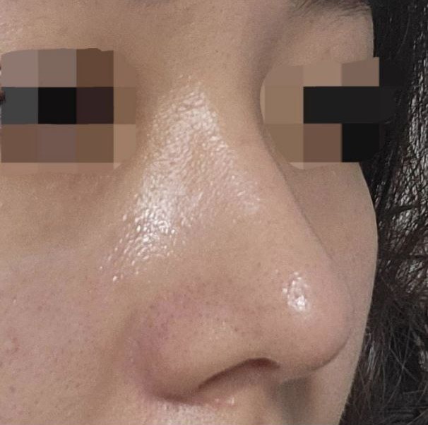 엄청고민하다 진행했는데 돈도 안아깝구 너무행복해요!