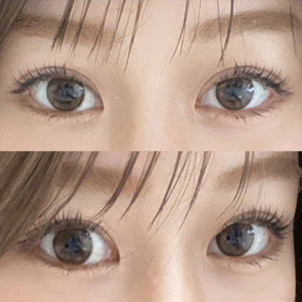 과잉진료 없고 수술하고 나서도 완전 잘 챙겨주셨어요ㅎㅎㅎ