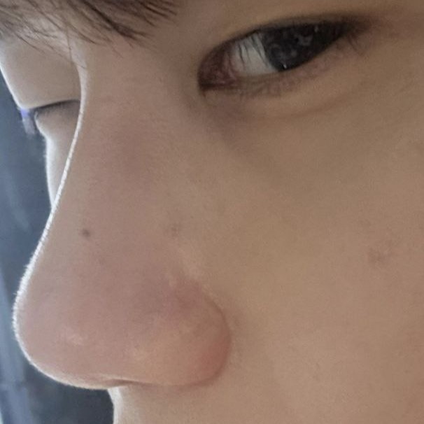 수술하기 잘한 거 같아요 감사합니다