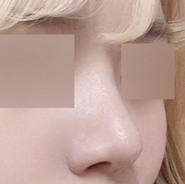 원장님에 대한 믿음감이 없으면 안했을거예요 ㅋㅋ