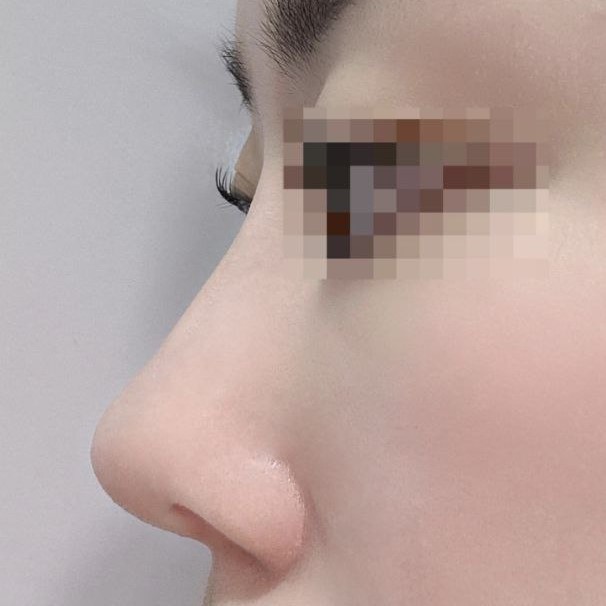 맘에 들어요! 한달 뒤 잔붓기까지 빠졌을 때가 너무 기대되요!