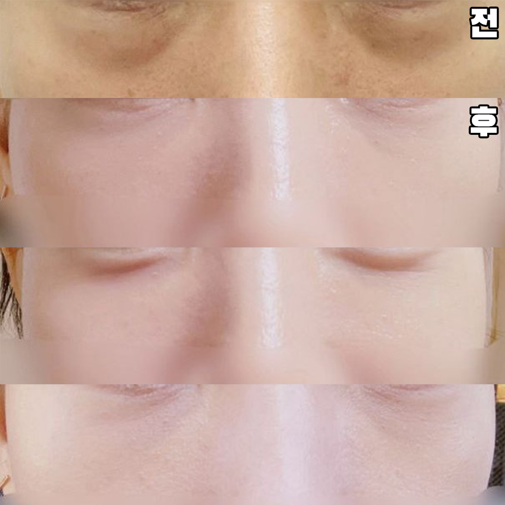 시간 지나면 더 좋아지길 기대하고 있어요.