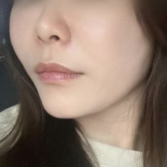 피치리프팅만 했는데 얼굴이 탱글하게 당겨줬어요 ㅎ