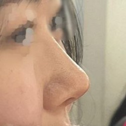 지금 만족도가 너무 높아서 항상 거울 보면서 감탄해요...