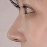 예쁜 눈,코 만들어주셔서 감사합니다