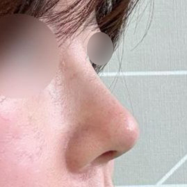 저도 전후 사진 차이보고 완전 놀랐네요 ㅎㅎ