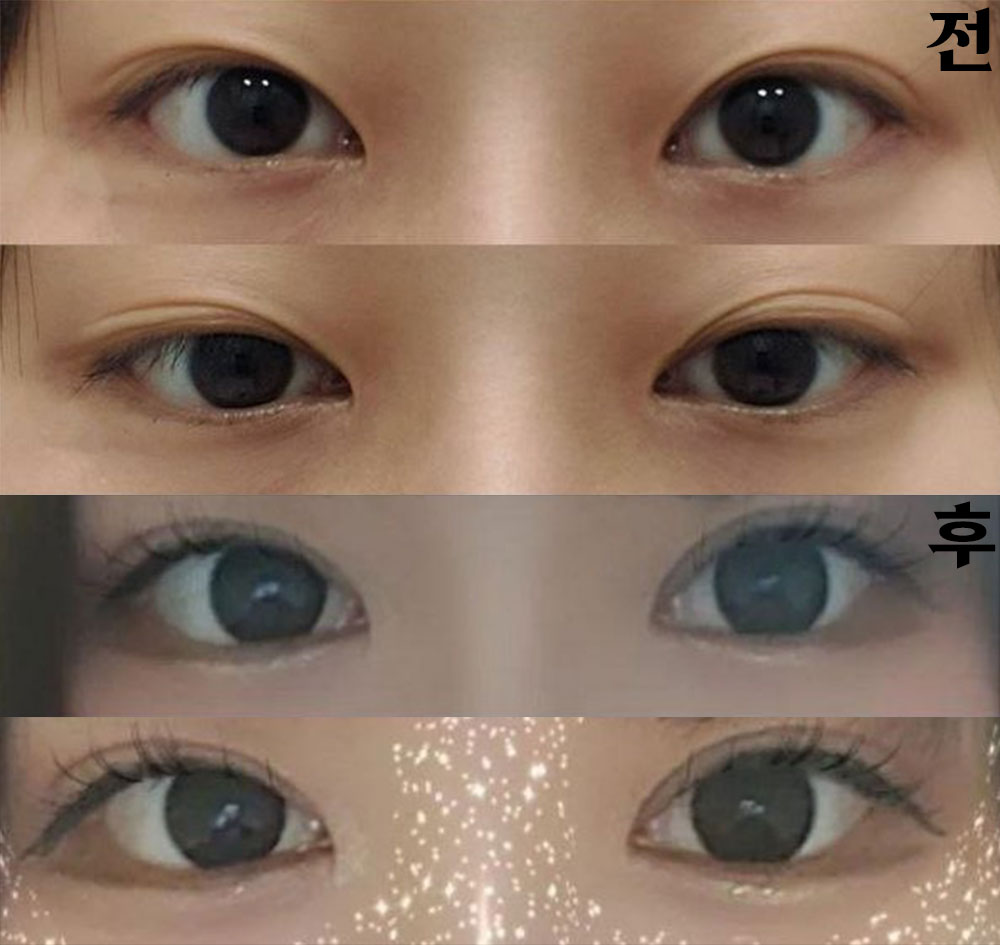 원장님도 친절하셔서 그냥 여기로 바로 결정했었어요!!