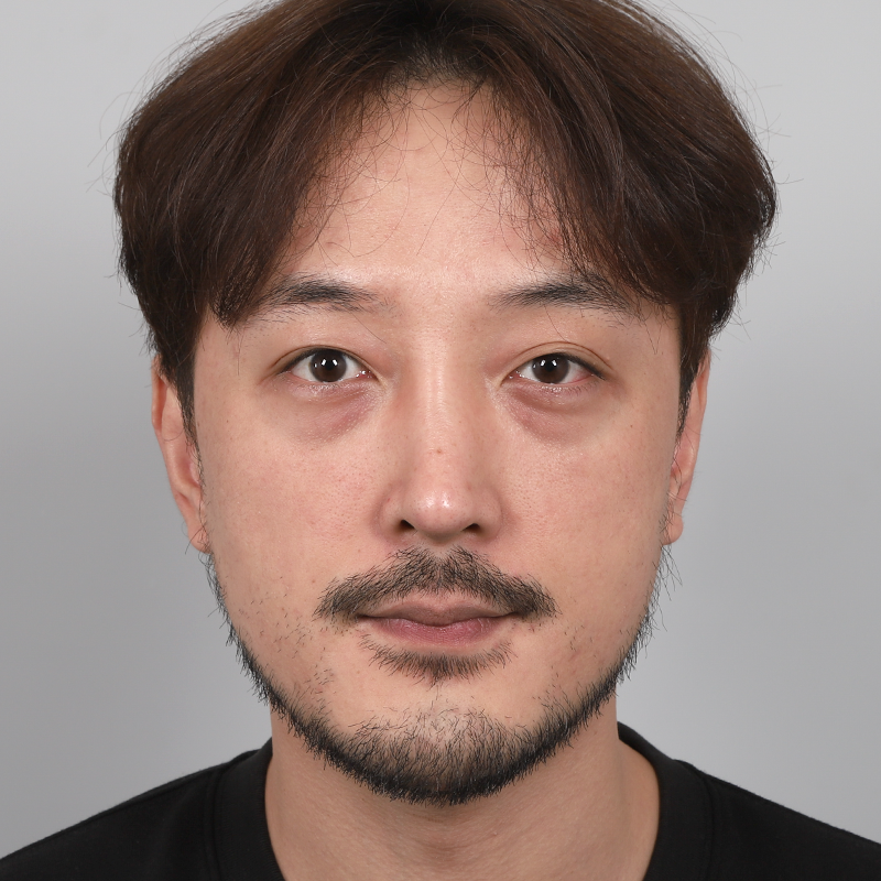 #부분절개 #눈밑지방재배치