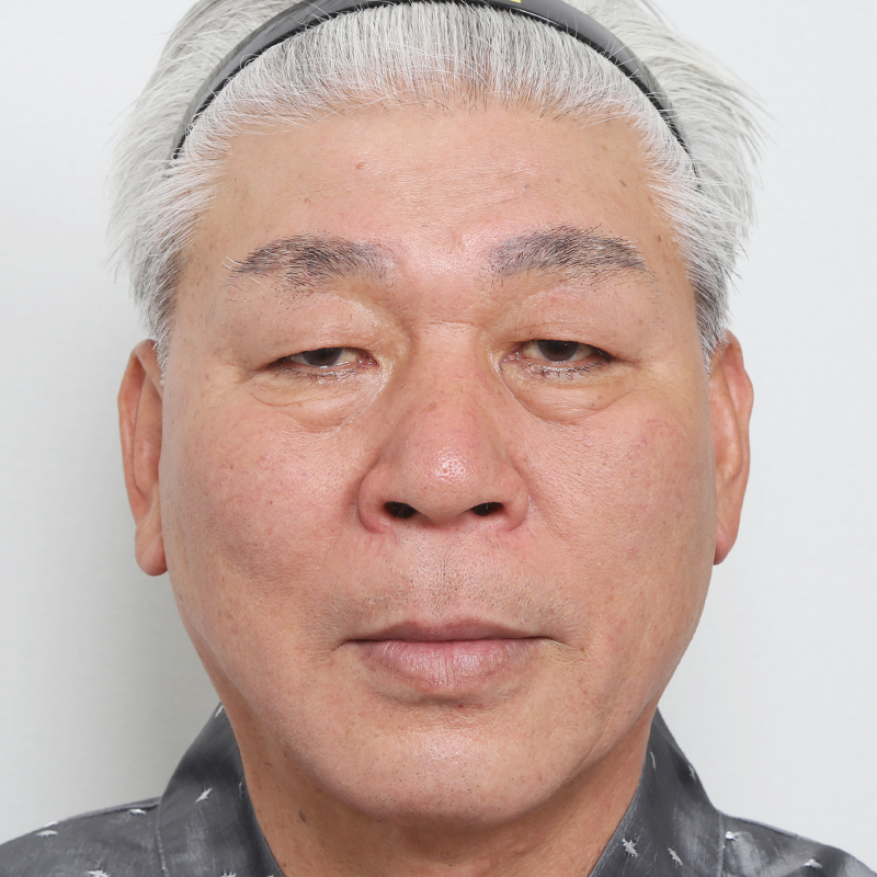 #하안검눈썹하거상