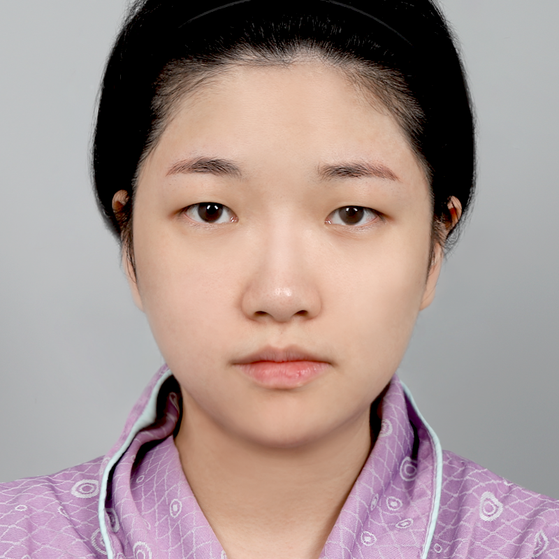 #콧대(실리콘) #코끝(자가연골) #부분절개 #눈매교정 #눈위지방제거