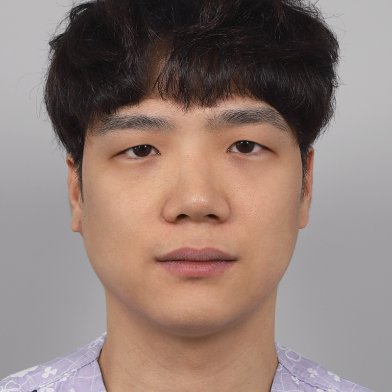 #부분절개 #눈매교정 #콧대(실리콘) #코끝(자가연골) #콧볼 축소 #복코교정